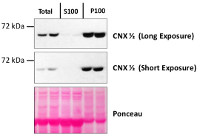 CNX1/2 | CALNEXIN HOMOLOG 1/2 in the group Antibodies for Plant/Algal  / Compartment Markers / Microsomal marker at Agrisera AB (Antibodies for research) (AS12 2365)